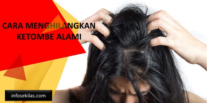 Cara Menghilangkan Ketombe Alami